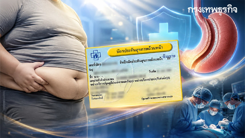 ได้เวลาลดความอ้วนฟรี เงื่อนไขใช้สิทธิ บัตรทอง 30 บาท ผ่าตัดโรคอ้วน