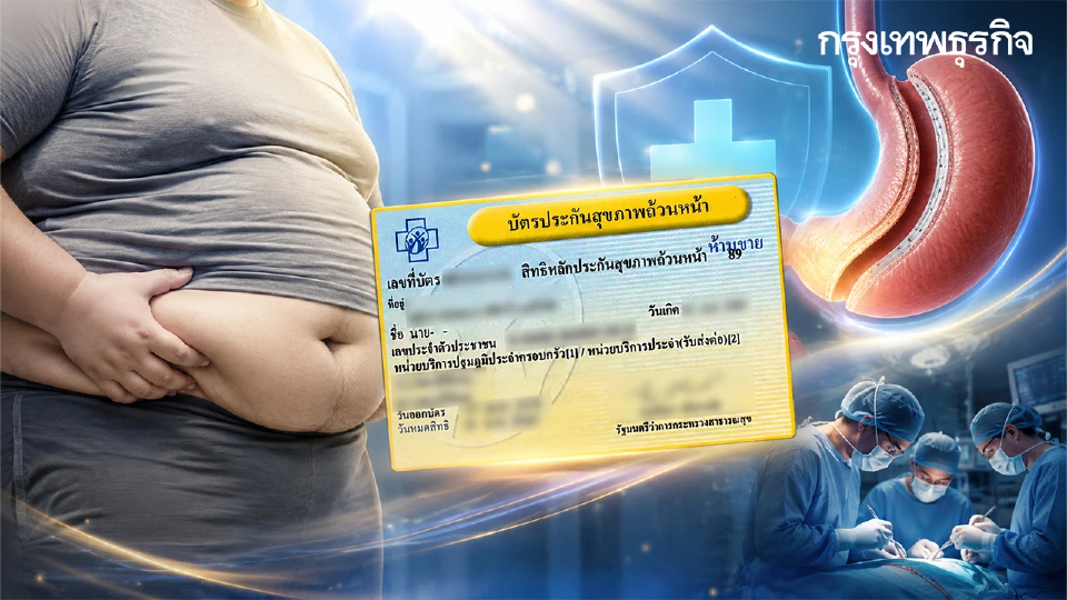 ได้เวลาลดความอ้วนฟรี เงื่อนไขใช้สิทธิ์ บัตรทอง 30 บาท ผ่าตัดโรคอ้วน