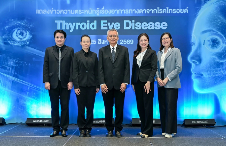 แพทย์เตือน ไทรอยด์เป็นพิษ อย่ามองข้ามอาการทางตา เสี่ยงสูญเสียการมองเห็น