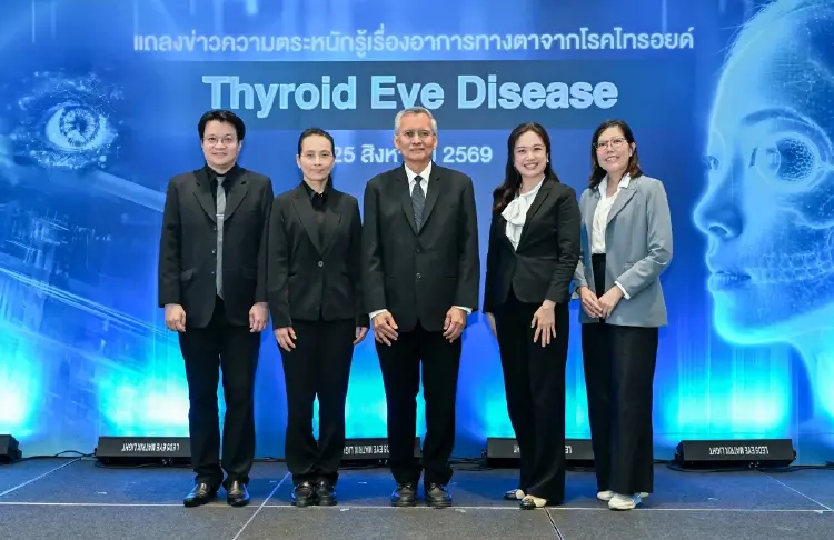 แพทย์เตือน ไทรอยด์เป็นพิษ อย่ามองข้ามอาการทางตา เสี่ยงสูญเสียการมองเห็น
